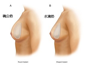  碗公奶 vs. 水滴奶