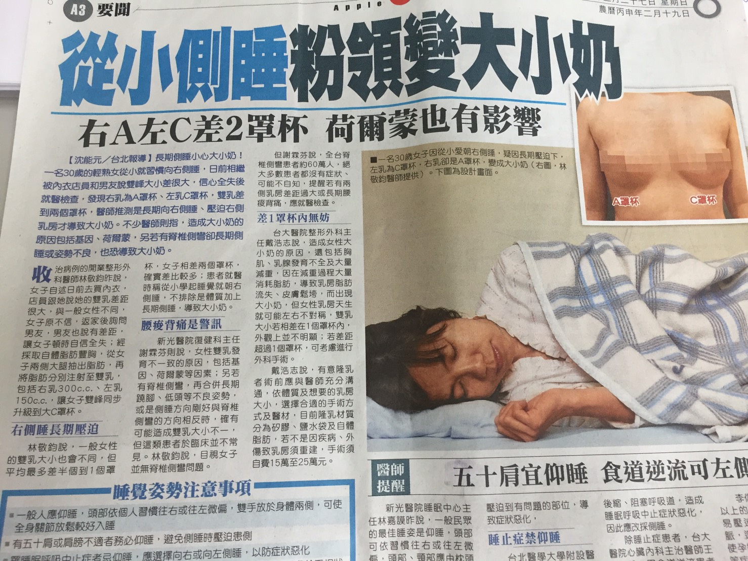 林敬鈞醫師接受蘋果日報要聞專訪隆乳