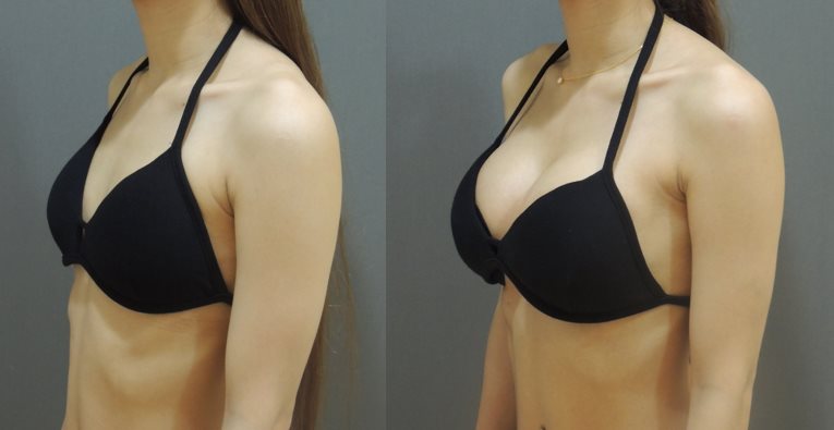 二代雙面蜜桃絨隆乳