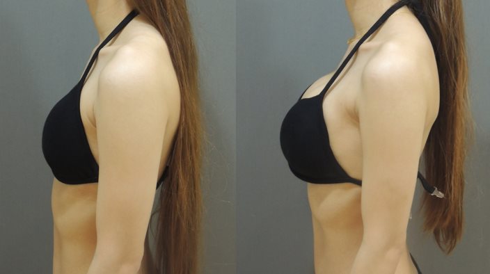 二代雙面蜜桃絨隆乳