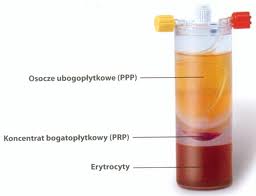 血小板豐富生長因子PRP(Platelet-Rich Plasma)