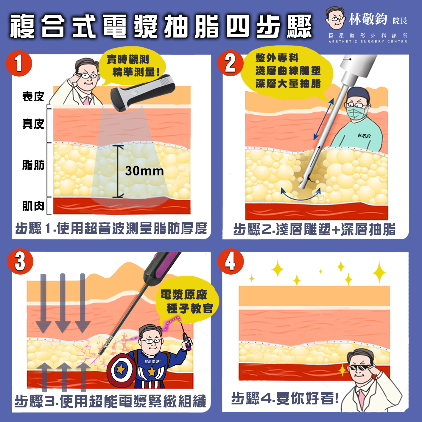 複合式電漿抽脂 手術方式