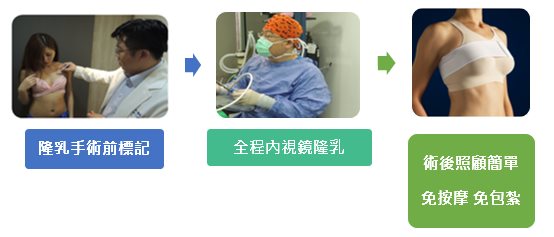 巨星整形外科林敬鈞隆乳手術流程