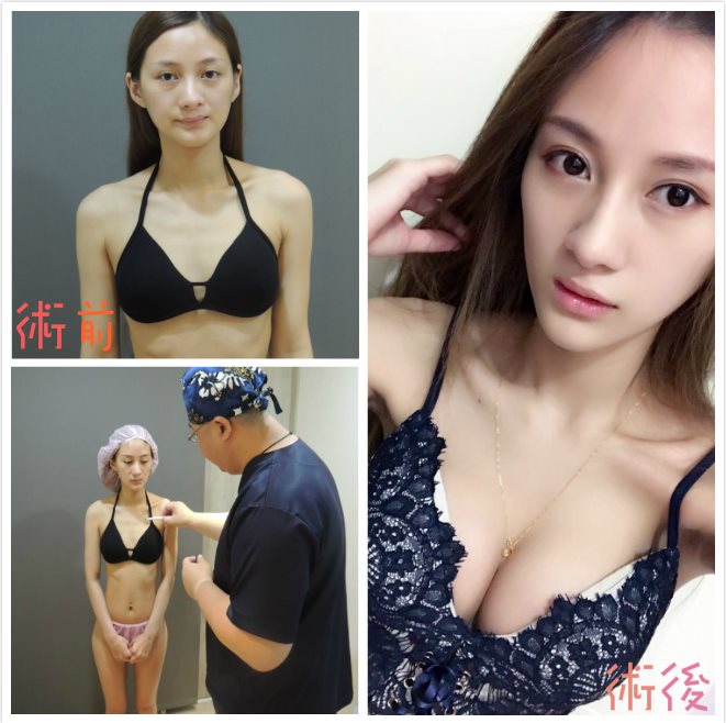 蜜桃絨隆乳