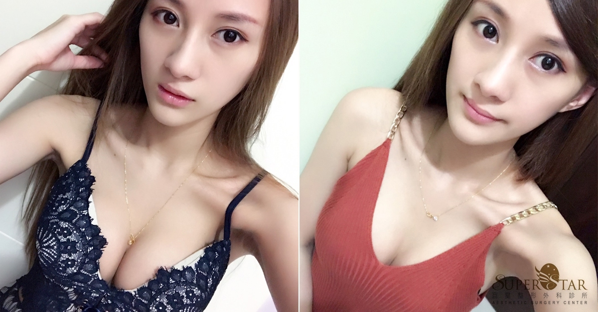 水滴果凍隆乳