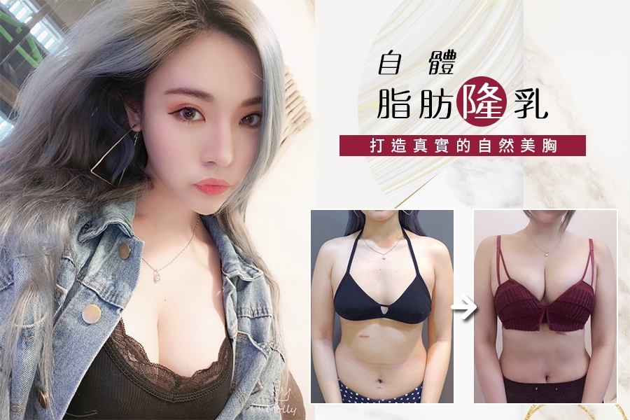 威塑 自體脂肪隆乳, 腹部抽脂