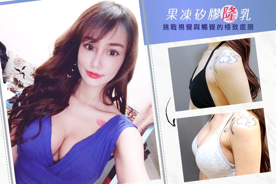 MOTIVA, 魔滴, 波力媚,林敬鈞隆乳, 台北隆乳