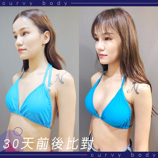 MOTIVA, 魔滴, 波力媚,林敬鈞隆乳, 台北隆乳