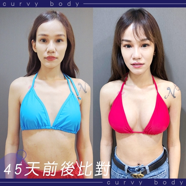 MOTIVA, 魔滴, 波力媚,林敬鈞隆乳, 台北隆乳