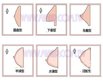 常見隆乳胸型 常見隆乳胸型